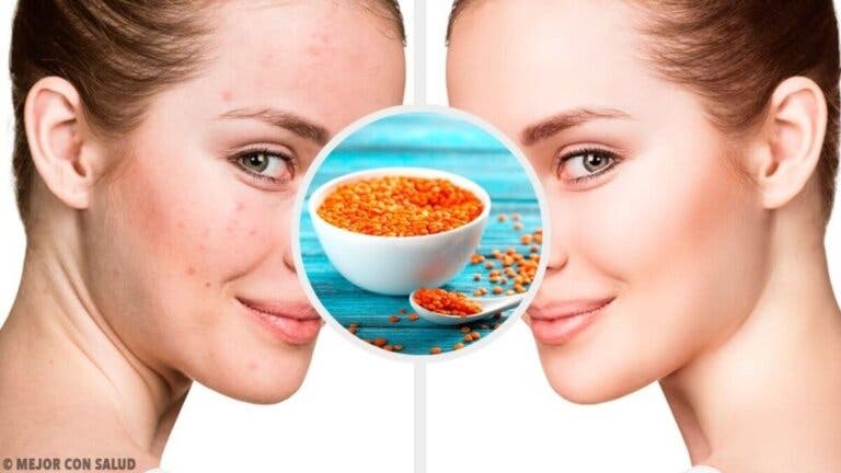 6 mascarillas faciales con lentejas rojas para distintos problemas