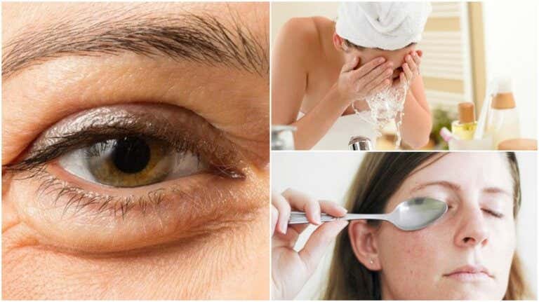 Consejos para reducir las bolsas de los ojos
