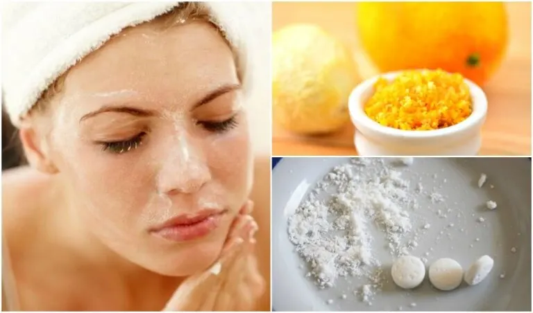 13 remedios para las espinillas del rostro