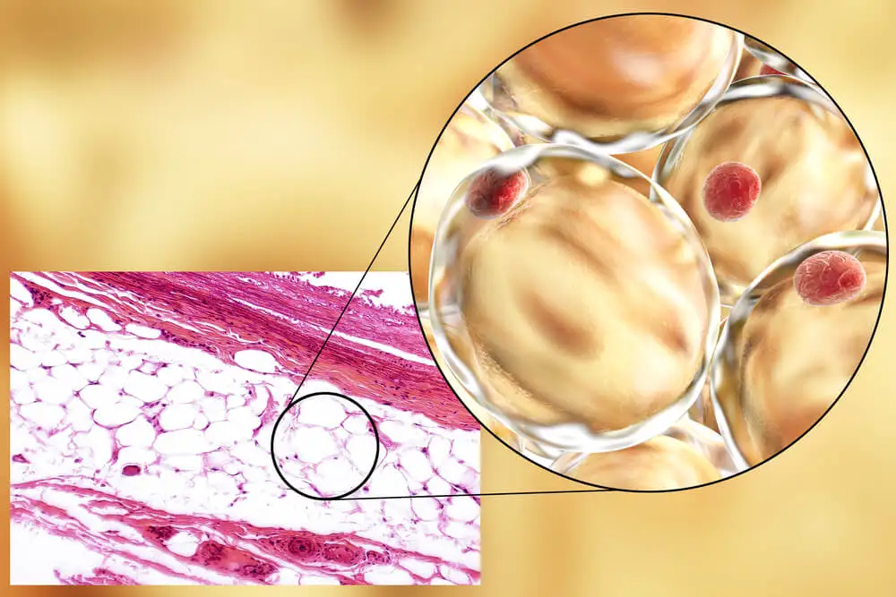 Fructosa, glucosa y adiponectina