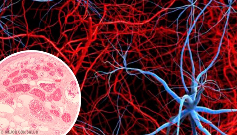 Angiogénesis: qué es y en qué consiste