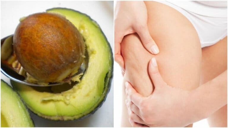 Cómo emplear la semilla de aguacate en el tratamiento de la celulitis