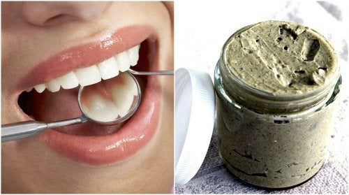 Cómo tratar y prevenir las caries con un remedio 100 % natural