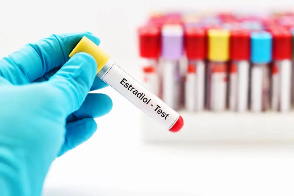 Alteraciones de estradiol