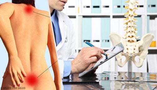 Hiperlordosis: qué es y en qué consiste