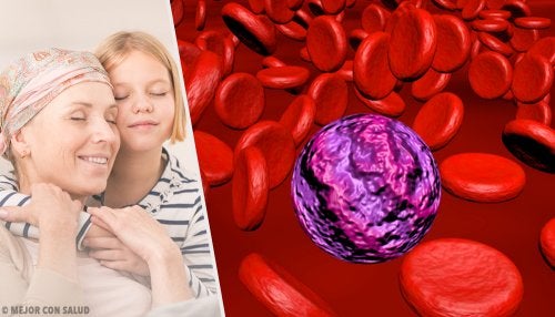 Leucemia mieloide aguda
