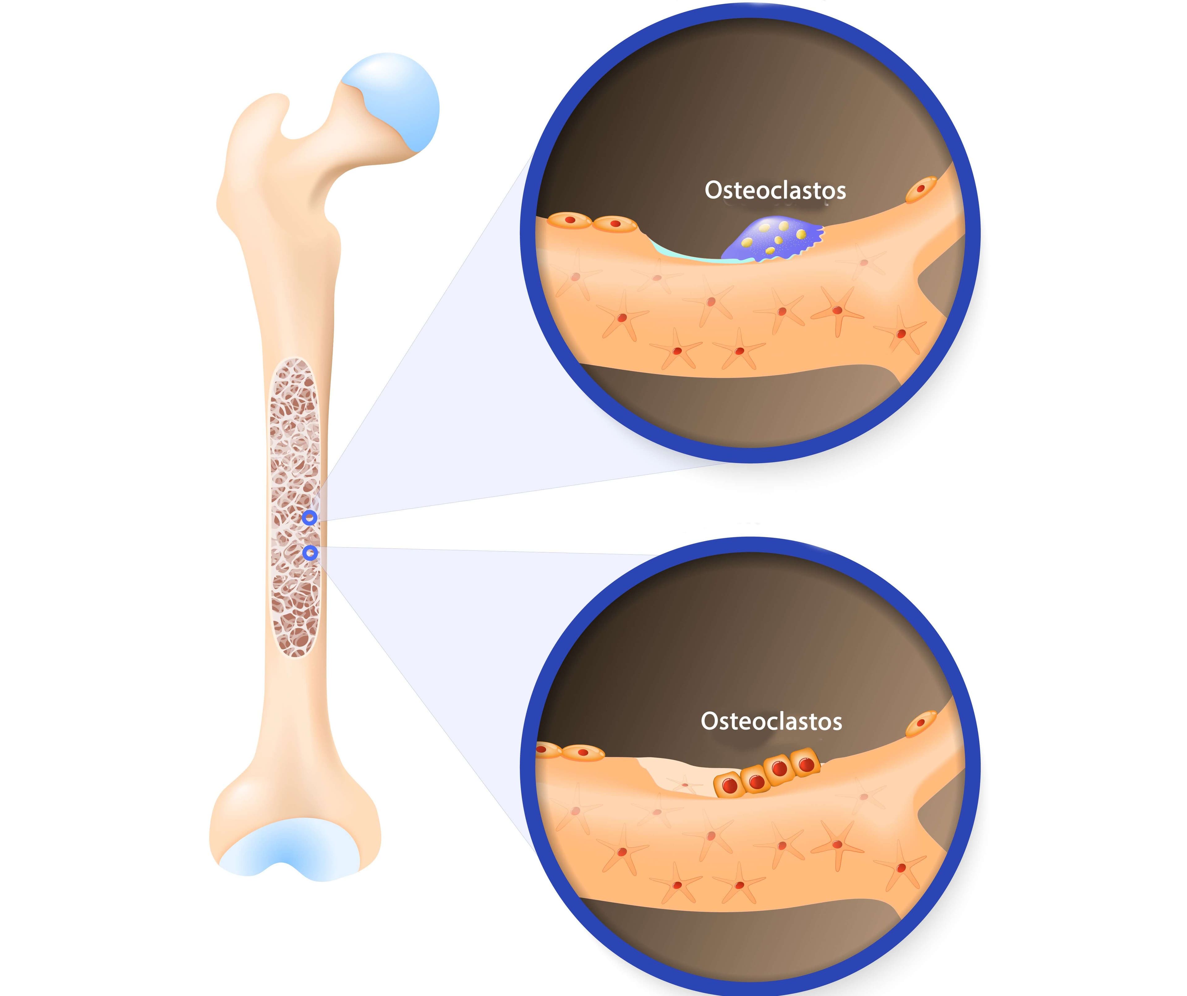 Los osteoclastos
