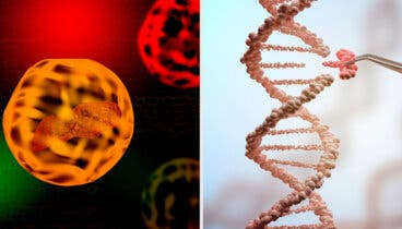 Mucopolisacaridosis: causas y síntomas