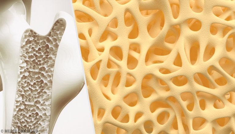 Osteogénesis imperfecta: causas y tipos