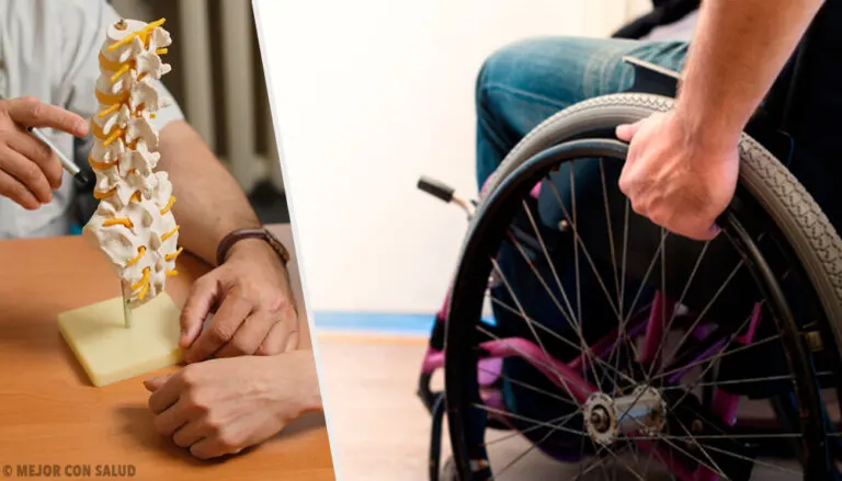 Paraplejia: todo lo que debes saber