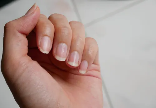 Por qué tenemos las uñas amarillentas