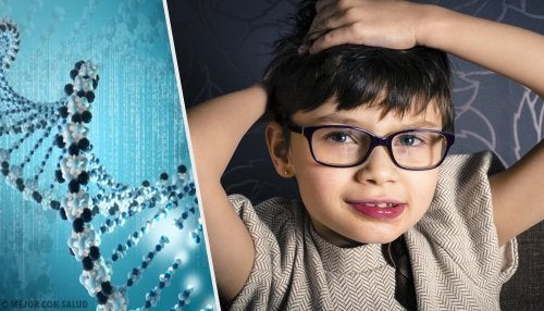 Síndrome de Rett: todo lo que debes saber