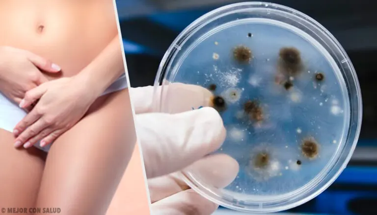 Infecciones vaginales: tipos y causas