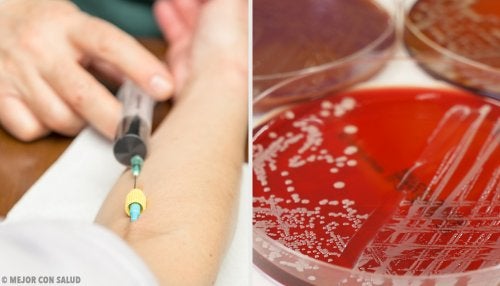 Tobramicina: qué es y cómo actúa
