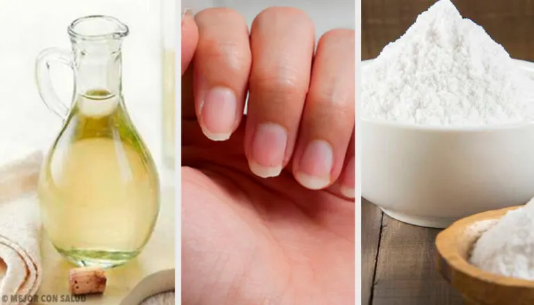 Uñas amarillentas: 4 remedios caseros para tratarlas