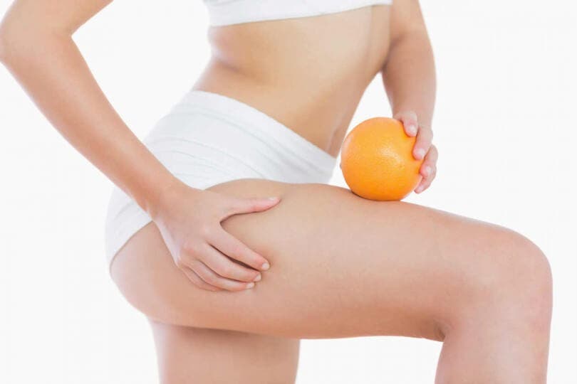 celulitis