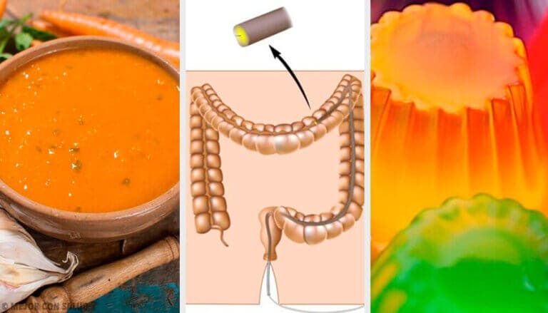 ¿Cuál es la dieta y preparación previa a una colonoscopia?