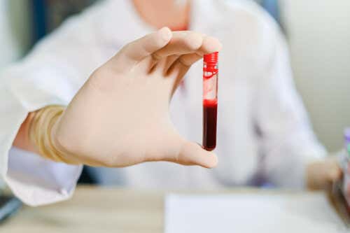 ¿Cuál es la diferencia entre suero y plasma sanguíneo?