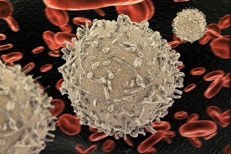 Leucopenia: causas y consecuencias