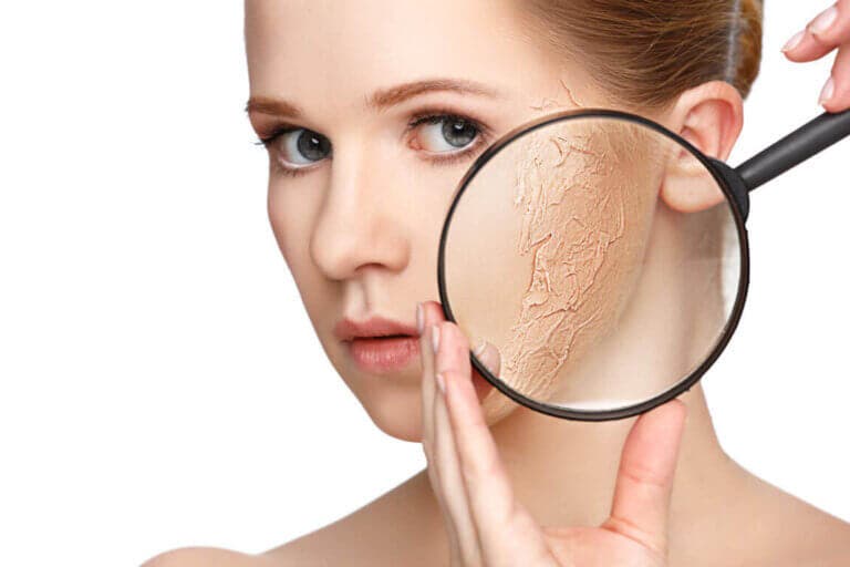 Los mejores productos naturales para la piel seca