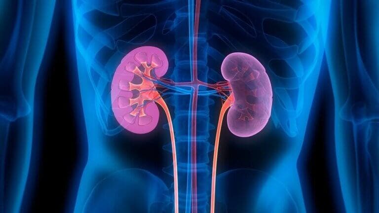 Síndrome de esclerosis renal