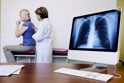 Asbestosis: signos y síntomas