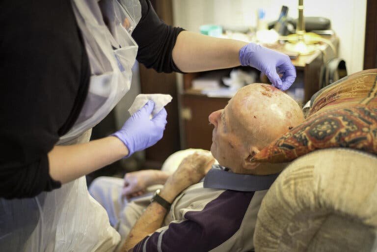 ¿Qué es un miniderrame cerebral? Claves para detectarlo