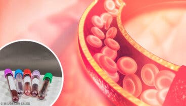 La trombopoyetina: síntesis y funciones