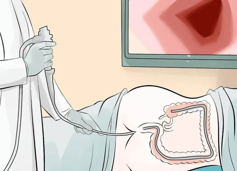 ¿Para qué se practica una colonoscopia?