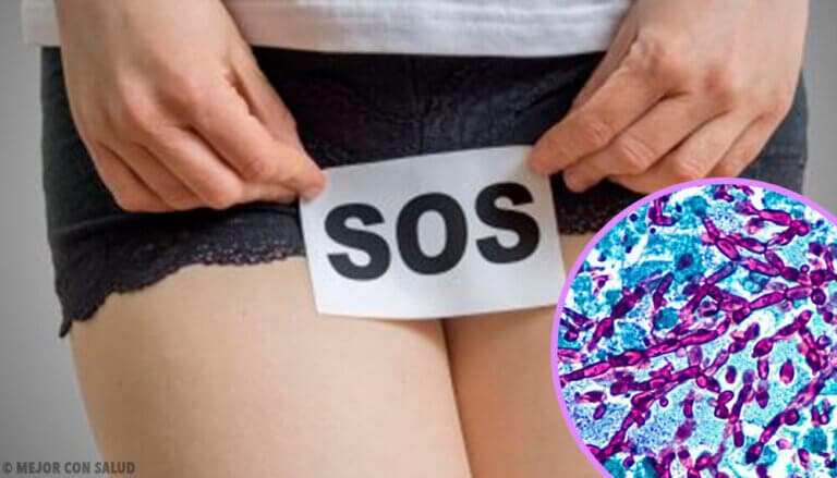 6 hábitos que te ocasionan infecciones por levadura