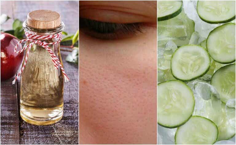 6 remedios naturales que puedes usar para cerrar los poros abiertos
