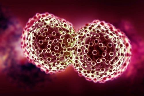 Características del cáncer avanzado