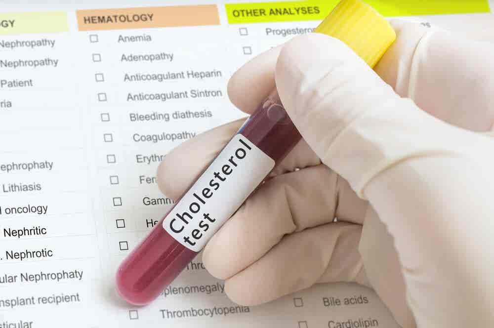 Las causas de la hipercolesterolemia