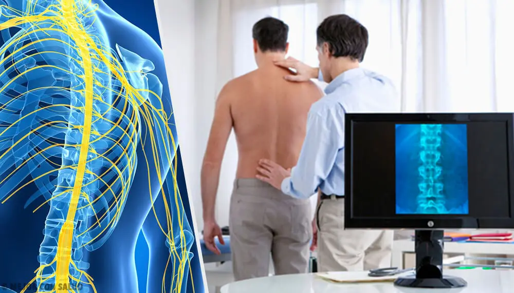 diagnóstico de esclerosis múltiple