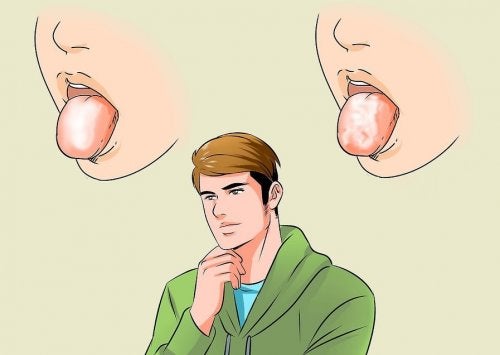 Glositis: todo lo que debes saber