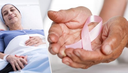 La radioterapia en el cáncer de mama