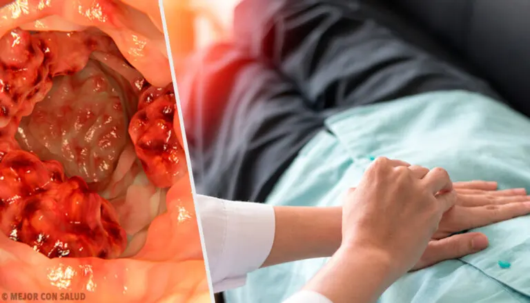 Principales vías de tratamiento para el cáncer de colon