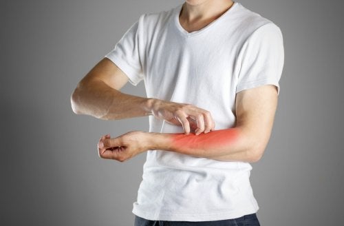 Hombre-rascandose-sintoma-de-un-eczema