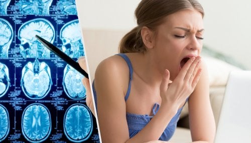 Todo sobre la narcolepsia, la necesidad de dormir