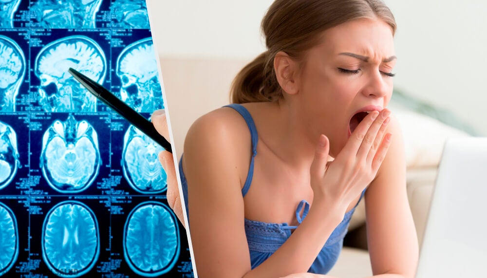 Todo sobre la narcolepsia, la necesidad de dormir