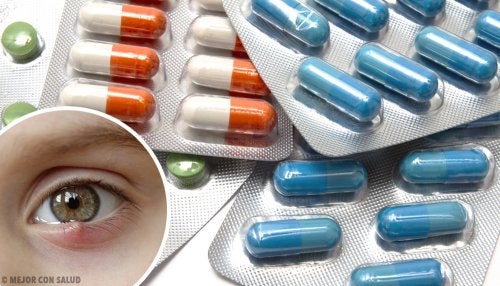 Tratamiento farmacológico del orzuelo o chalación