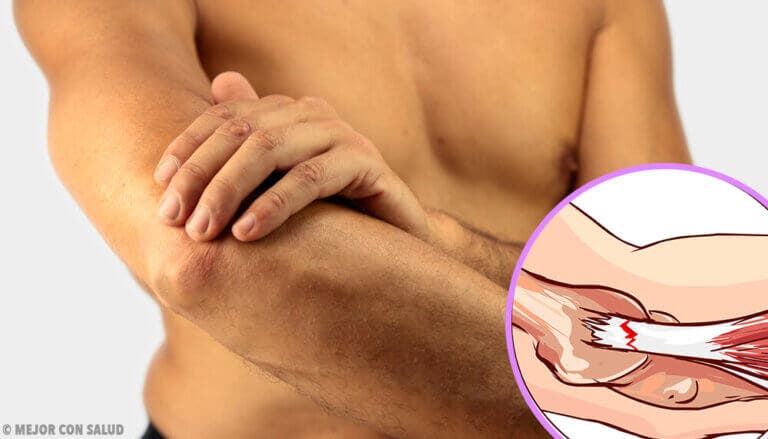 Tratamiento y prevención de la epicondilitis