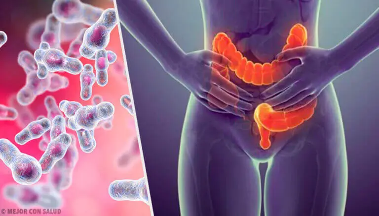 Colitis microscópica: todo lo que debes saber