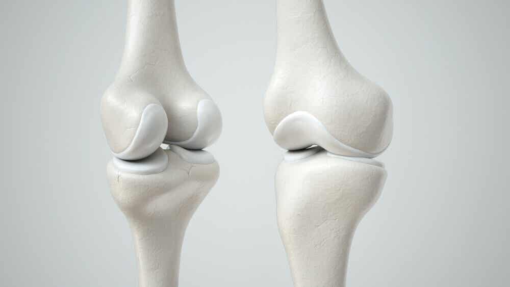Huesos que se afectan por la osteogénesis imperfecta.