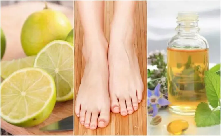 Cómo combatir los hongos en las uñas