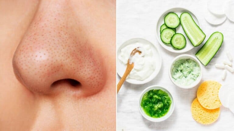 12 mascarillas caseras para los puntos negros