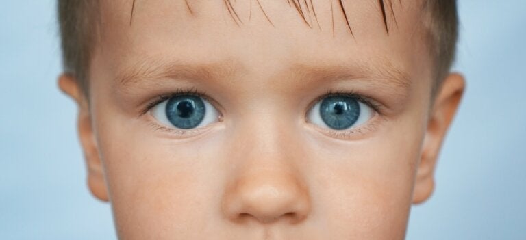 Anisocoria o asimetría en la dilatación de las pupilas