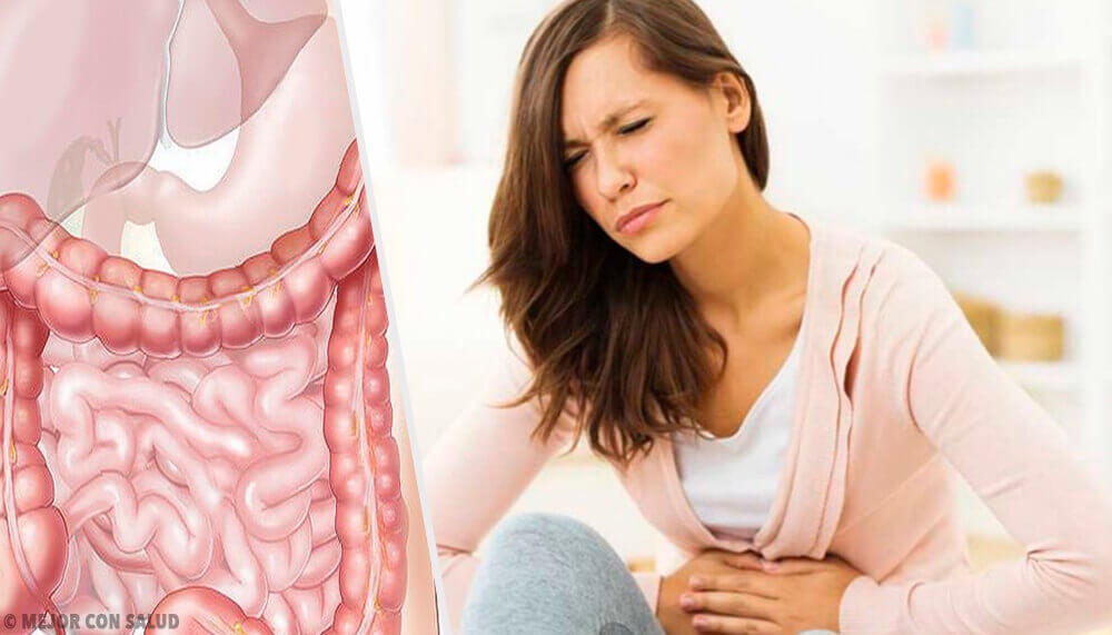 Conoce El Síndrome De Malabsorción Intestinal Mejor Con Salud 2735