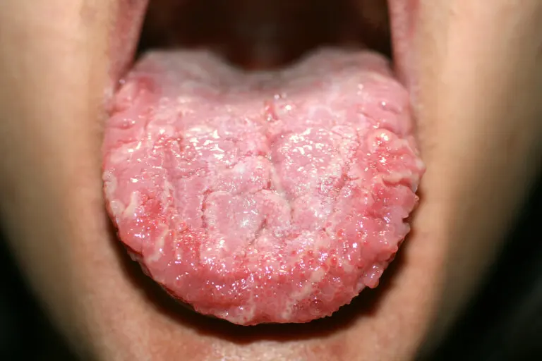 ¿Qué es la lengua geográfica?