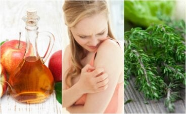 6 remedios naturales para el prurito cutáneo